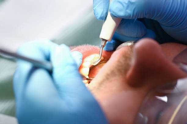 Best Walk-In Emergency Dentist in Gaylord, MI