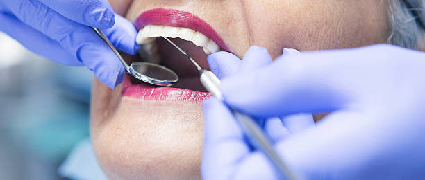 Best Emergency Broken Tooth Repair in Gaylord, MI